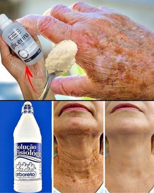 Remover Manchas e Rugas