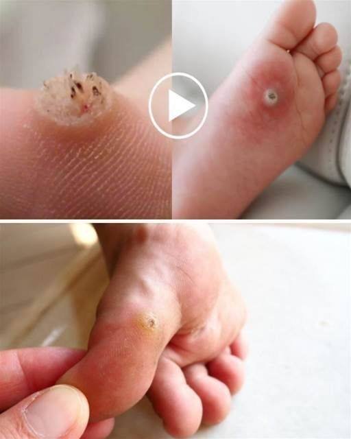 Se você tem isso é um sinal claro que você está